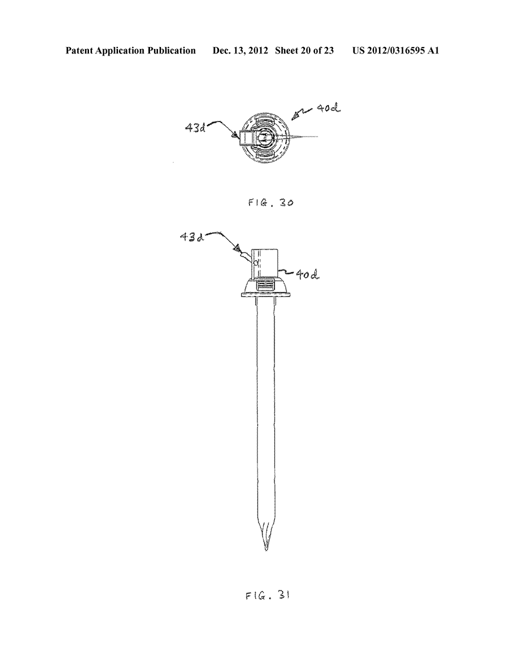 BLADELESS OPTICAL OBTURATOR - diagram, schematic, and image 21