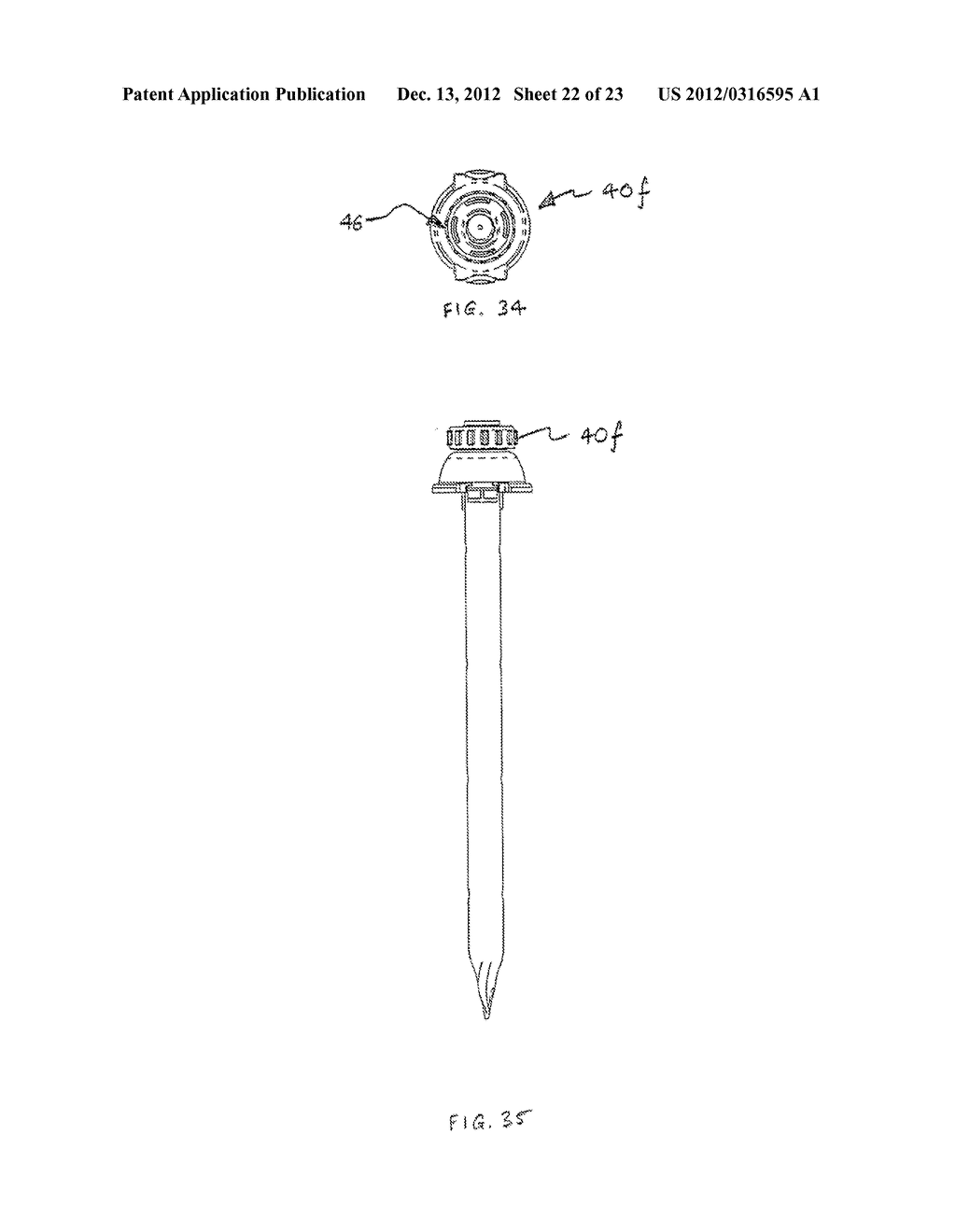 BLADELESS OPTICAL OBTURATOR - diagram, schematic, and image 23