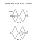 Catching Mechanisms for Tubular Septal Occluder diagram and image