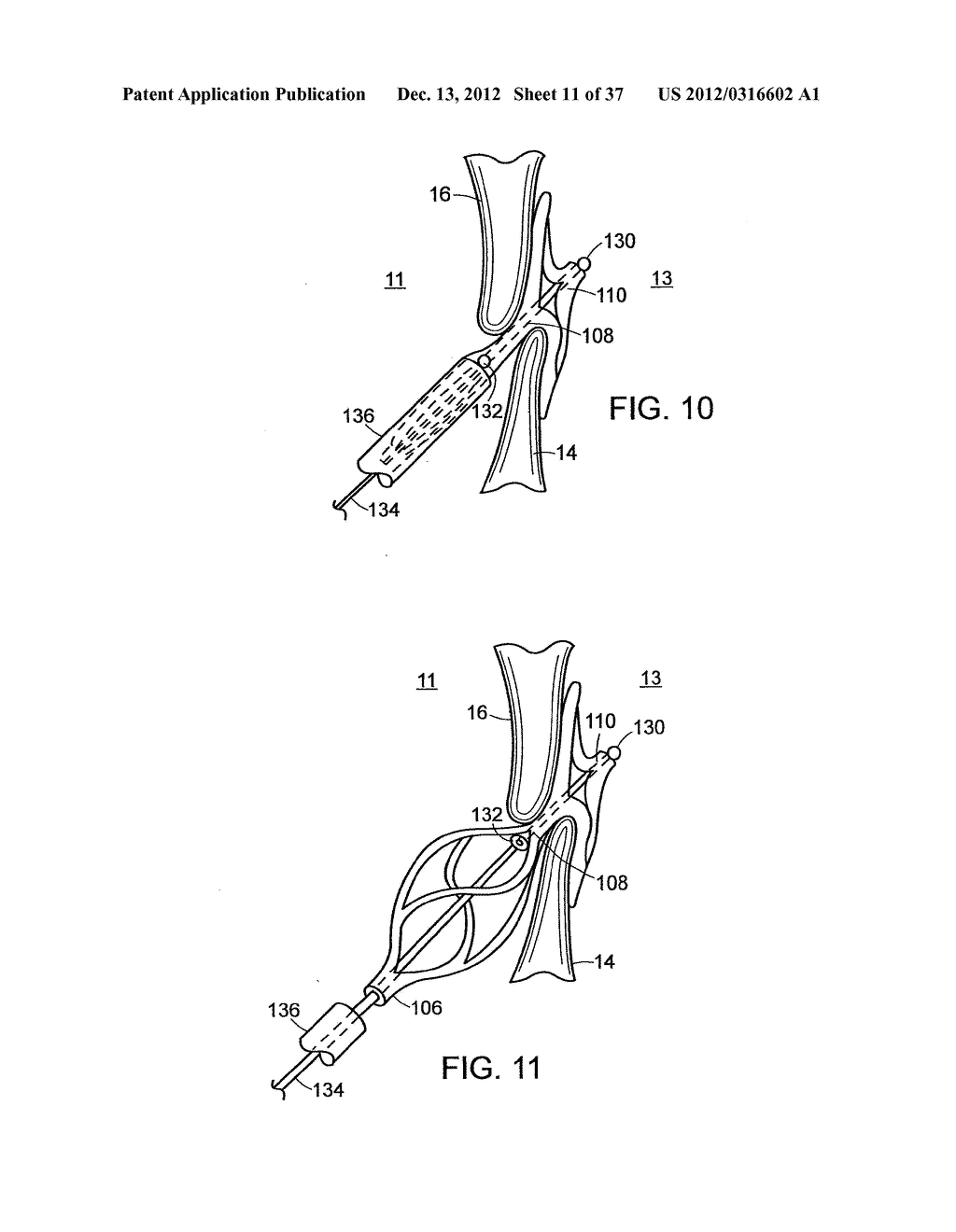 Catching Mechanisms for Tubular Septal Occluder - diagram, schematic, and image 12