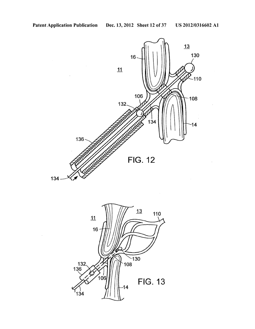 Catching Mechanisms for Tubular Septal Occluder - diagram, schematic, and image 13