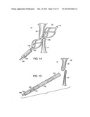 Catching Mechanisms for Tubular Septal Occluder diagram and image