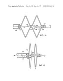 Catching Mechanisms for Tubular Septal Occluder diagram and image