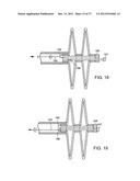 Catching Mechanisms for Tubular Septal Occluder diagram and image