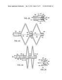 Catching Mechanisms for Tubular Septal Occluder diagram and image