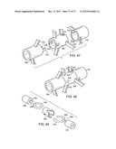 Catching Mechanisms for Tubular Septal Occluder diagram and image