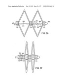 Catching Mechanisms for Tubular Septal Occluder diagram and image