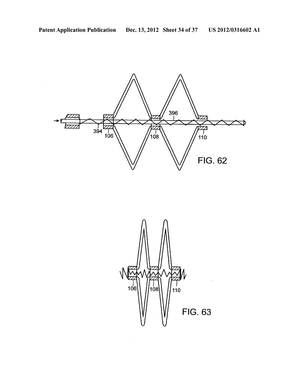 Catching Mechanisms for Tubular Septal Occluder - diagram, schematic, and image 35