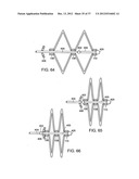 Catching Mechanisms for Tubular Septal Occluder diagram and image