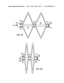 Catching Mechanisms for Tubular Septal Occluder diagram and image