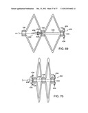 Catching Mechanisms for Tubular Septal Occluder diagram and image