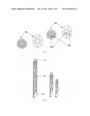 Retrievable covered stent for bifurcation aneurysms diagram and image