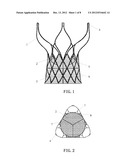 INVASIVE CARDIAC VALVE diagram and image