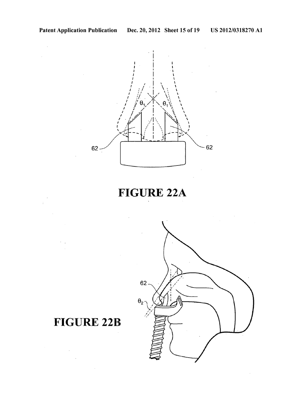 NASAL INTERFACE - diagram, schematic, and image 16