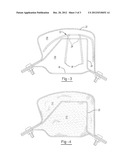 CAVITY SEALING ASSEMBLY diagram and image