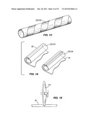 METHOD AND APPARATUS FOR REMOVING A FILM FROM A SURFACE diagram and image