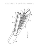 RADIOACTIVE THERAPEUTIC FASTENING INSTRUMENT diagram and image