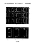 Method for Compensating for Respiratory Motion in Magnetic Resonance     Imaging diagram and image