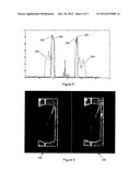 Method for Compensating for Respiratory Motion in Magnetic Resonance     Imaging diagram and image