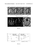 SYSTEMS AND METHODS FOR IMAGING AND QUANTIFYING TISSUE MAGNETISM WITH     MAGNETIC RESONANCE IMAGING diagram and image