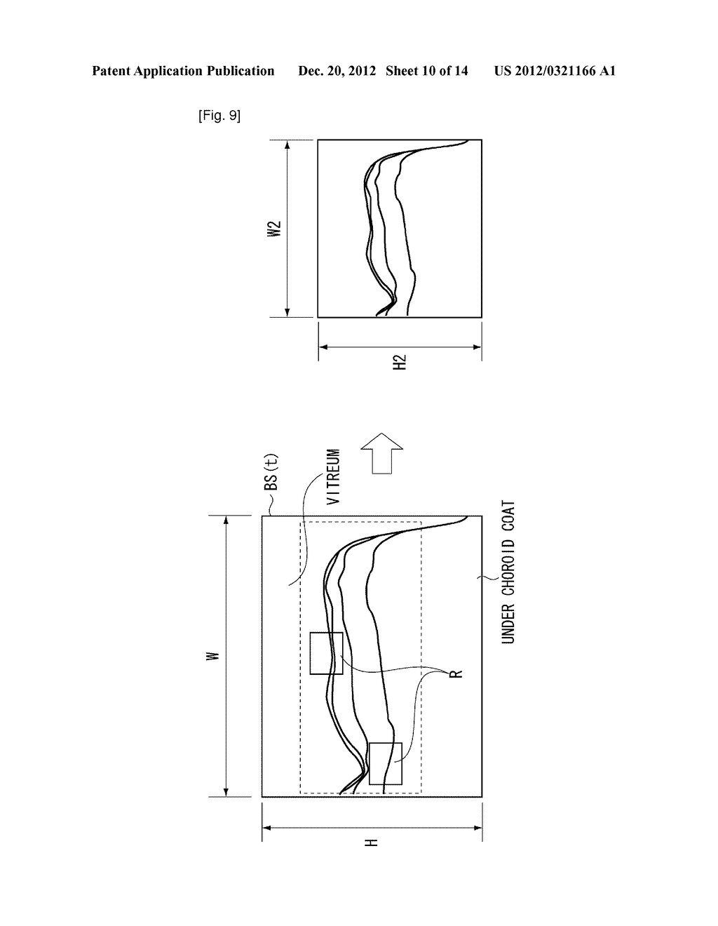 IMAGE PROCESSING APPARATUS, CONTROL METHOD, AND OPTICAL COHERENCE     TOMOGRAPHY SYSTEM - diagram, schematic, and image 11