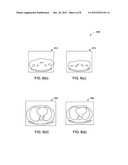 METHOD FOR AUTOMATIC MISMATCH CORRECTION OF IMAGE VOLUMES diagram and image