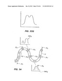 OPTICAL FIBER INSTRUMENT SYSTEM FOR DETECTING AND DECOUPLING TWIST EFFECTS diagram and image