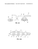 OPTICAL FIBER INSTRUMENT SYSTEM FOR DETECTING AND DECOUPLING TWIST EFFECTS diagram and image