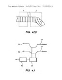 OPTICAL FIBER INSTRUMENT SYSTEM FOR DETECTING AND DECOUPLING TWIST EFFECTS diagram and image