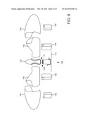 Rotor Hub Maintenance System diagram and image