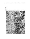 PLEXIN D1 AS A TARGET FOR TUMOR DIAGNOSIS AND THERAPY diagram and image