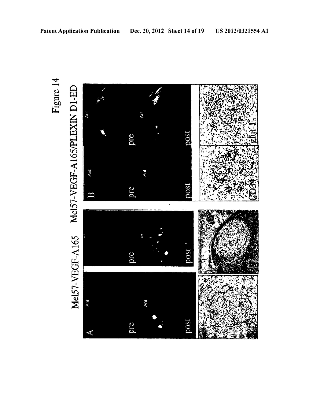 PLEXIN D1 AS A TARGET FOR TUMOR DIAGNOSIS AND THERAPY - diagram, schematic, and image 15