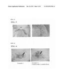 KIT FOR ADHERING BIOLOGICAL HARD TISSUES diagram and image