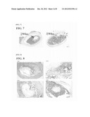 KIT FOR ADHERING BIOLOGICAL HARD TISSUES diagram and image