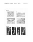 KIT FOR ADHERING BIOLOGICAL HARD TISSUES diagram and image