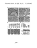 METHODS AND COMPOSITIONS FOR THE INHIBITION OF STAT5 IN PROSTATE CANCER     CELLS diagram and image