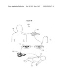 Method for reducing heat loss in neonatal mammalian subjects by     transplanting brown adipocytes or precursors thereof diagram and image