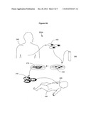 Method for reducing heat loss in neonatal mammalian subjects by     transplanting brown adipocytes or precursors thereof diagram and image