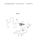 Method for reducing heat loss in neonatal mammalian subjects by     transplanting brown adipocytes or precursors thereof diagram and image