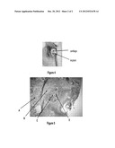 INTRA-ARTICULARLY SUPPLEMENTATION METHOD FOR TREATING JOINT DISEASES AND     INJURIES diagram and image