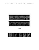 Liposome-Encapsulated Bicelles and Use Thereof in Diluted Systems diagram and image