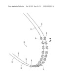 Customized Orthodontic Arch Wire Manufactured Using Model of Patient s     Teeth diagram and image