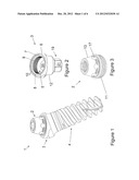 MODULAR ABUTMENT SYSTEM FOR TILTED DENTAL IMPLANTS diagram and image