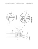 MODULAR ABUTMENT SYSTEM FOR TILTED DENTAL IMPLANTS diagram and image