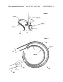 SPORT TRAINING APPARATUS  AND METHOD OF USE diagram and image