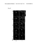 THERAPEUTIC AGENT FOR AUTOIMMUNE DISEASES OR ALLERGY, AND METHOD FOR     SCREENING FOR THE THERAPEUTIC AGENT diagram and image