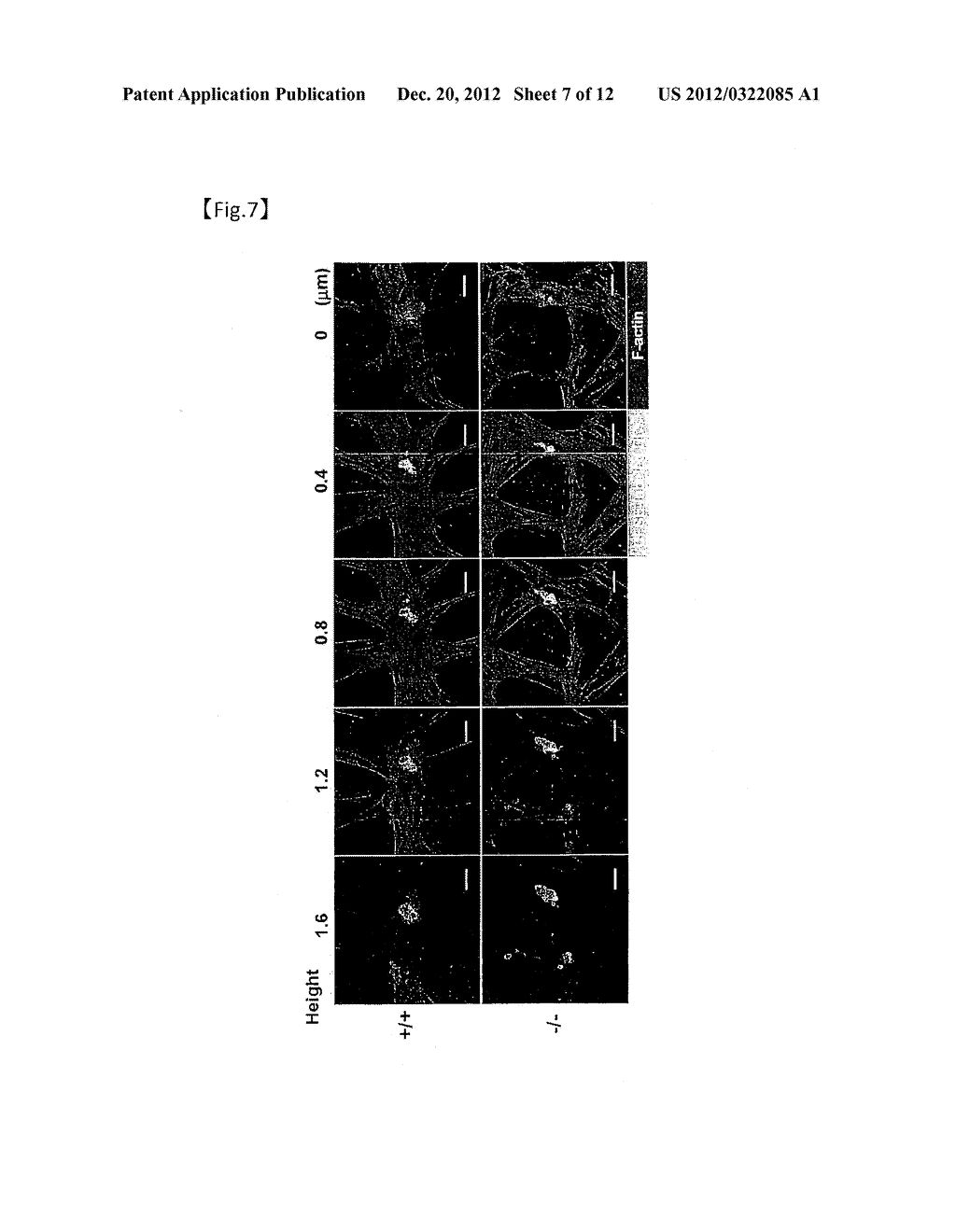 THERAPEUTIC AGENT FOR AUTOIMMUNE DISEASES OR ALLERGY, AND METHOD FOR     SCREENING FOR THE THERAPEUTIC AGENT - diagram, schematic, and image 08