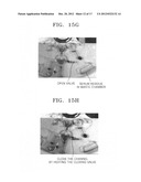 CENTRIFUGAL FORCE-BASED MICROFLUIDIC DEVICE FOR NUCLEIC ACID EXTRACTION     AND MICROFLUIDIC SYSTEM INCLUDING THE MICROFLUIDIC DEVICE diagram and image