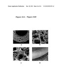 Novel Biodegradable Elastomeric Scaffold for Tissue Engineering and Light     Scattering Fingerprinting Methods for Testing the Same diagram and image