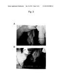 THERAPEUTIC AGENT FOR USE IN A METHOD OF TREATING PSORIASIS OR ATOPIC     DERMATITIS diagram and image